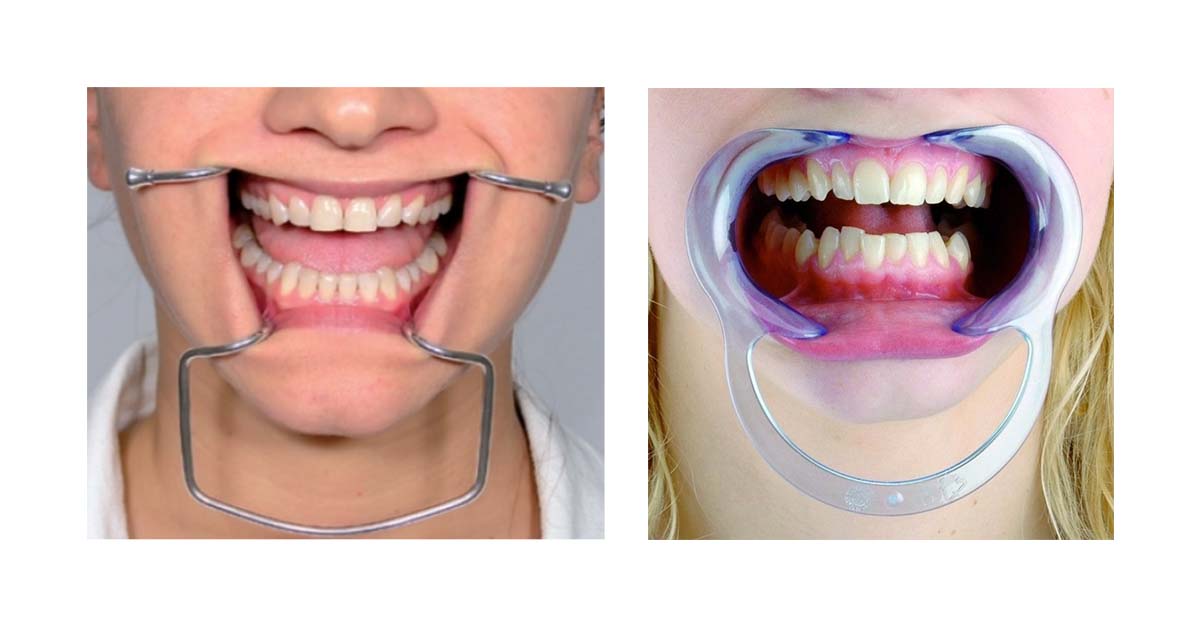 cheek retractors