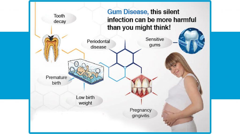 Gestational Diabetes