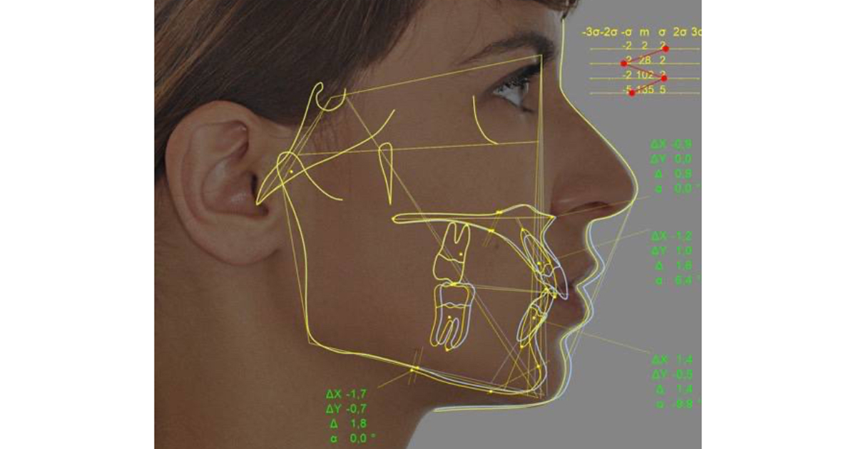 New Software for Cephalometric Tracing