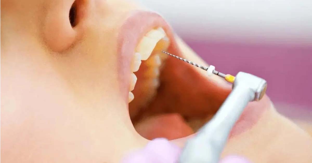 Endomotor and Single-Sitting RCTs
