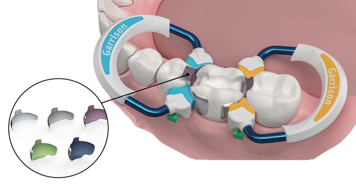 Precontoured Sectional Matrix bands 
