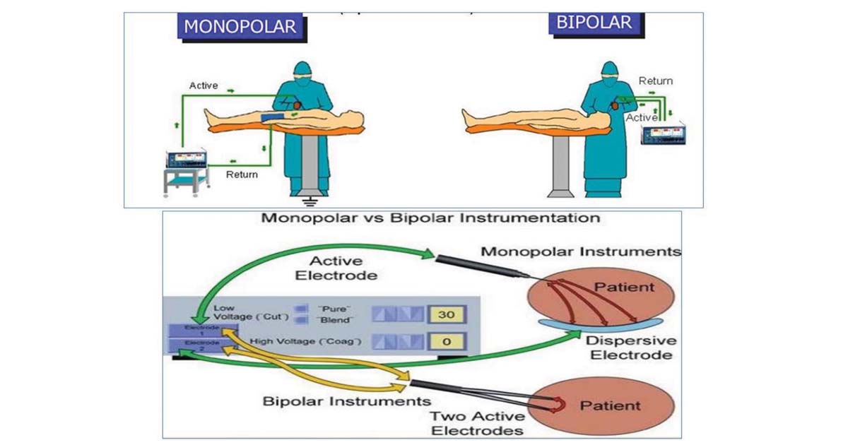 Principle of Electrosurgery