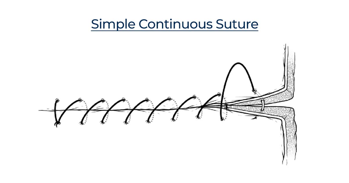 Simple Continuous