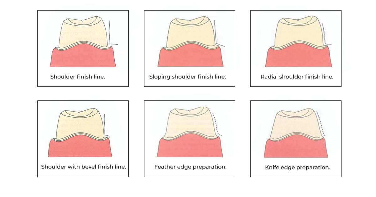Finish Line Configurations