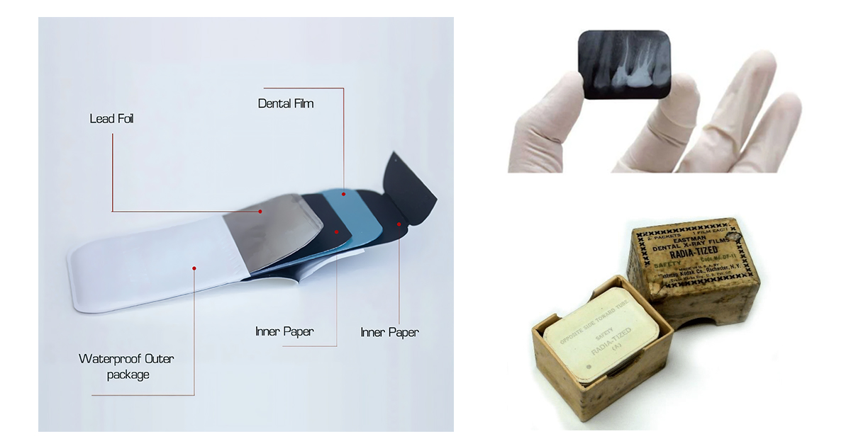 traditional radiography