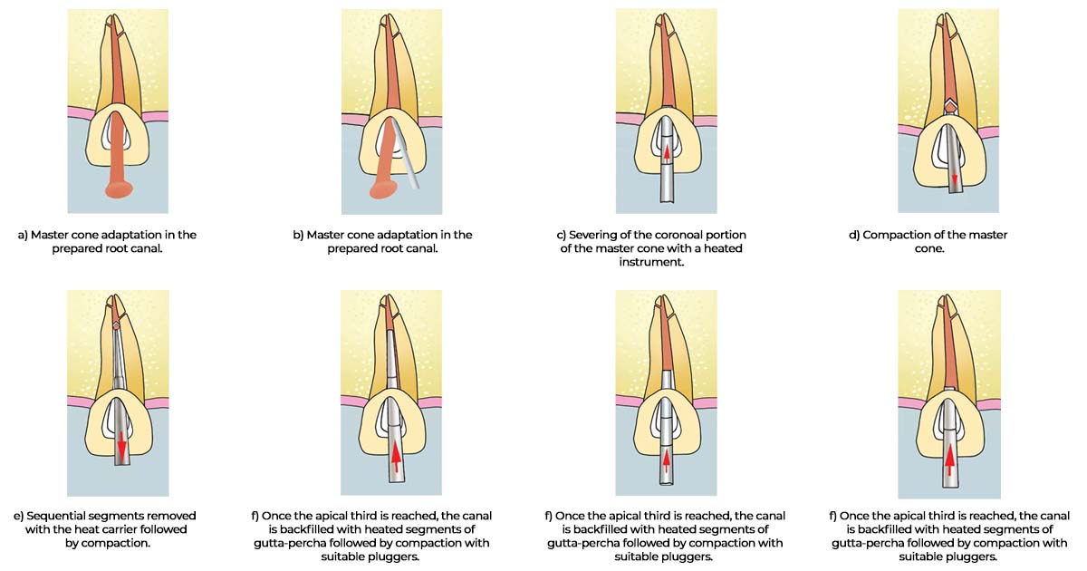 Warm vertical Compaction
