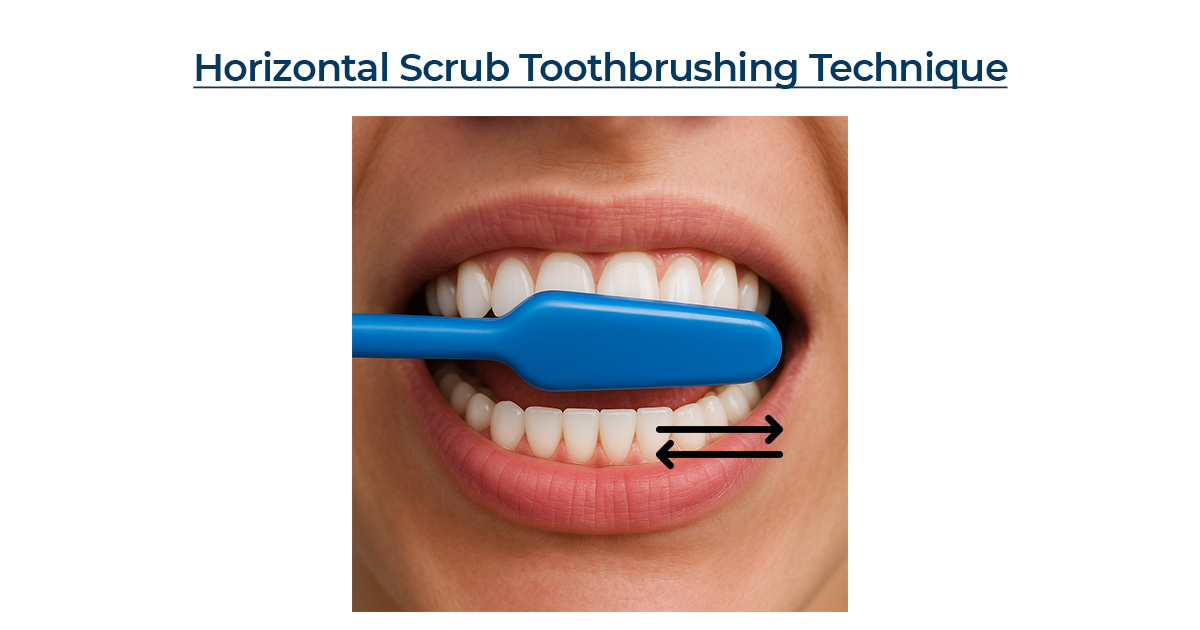 Horizontal Scrub Technique