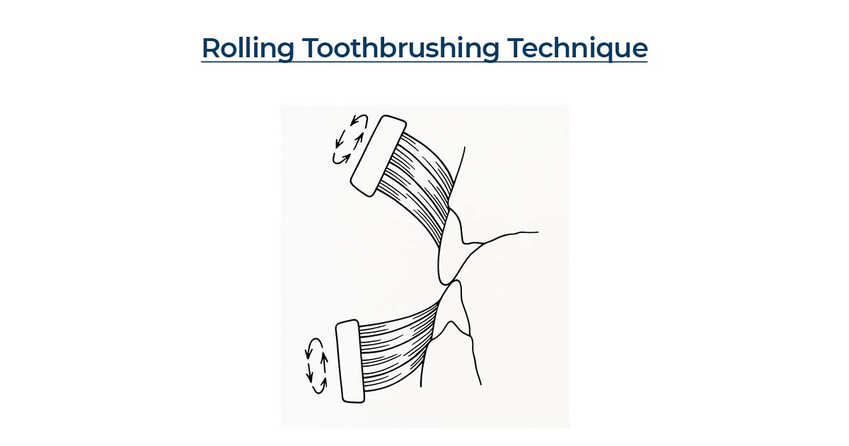 Rolling Toothbrushing Technique
