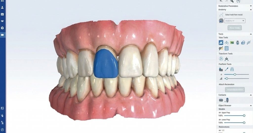 digital designing of tooth