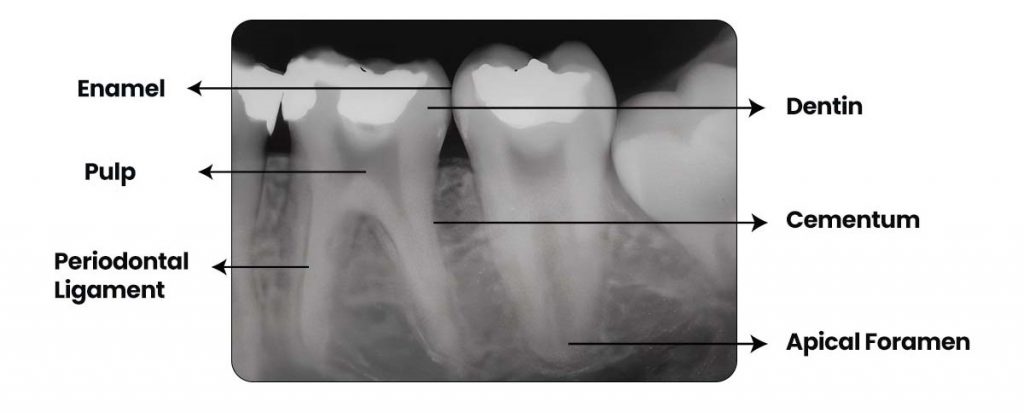 Periapical Region