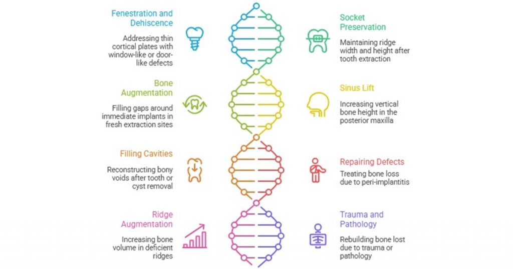 Indications for GBR.