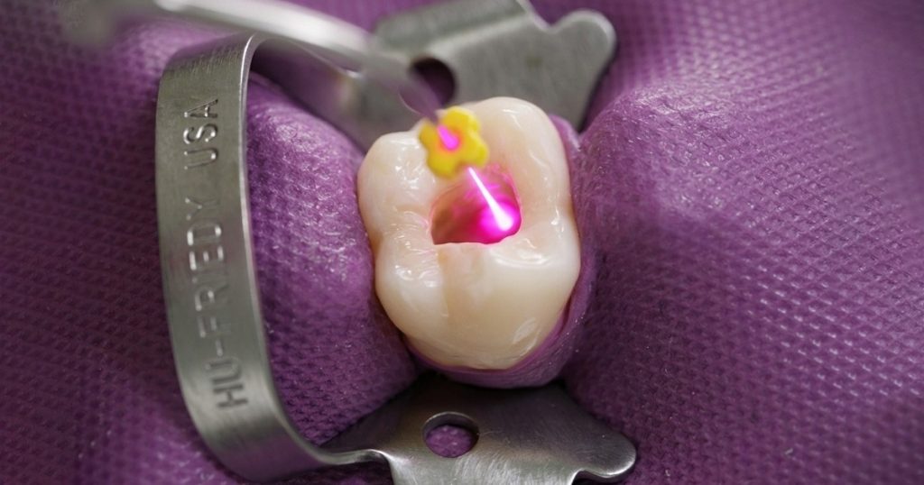 laser treatment on damaged teeth