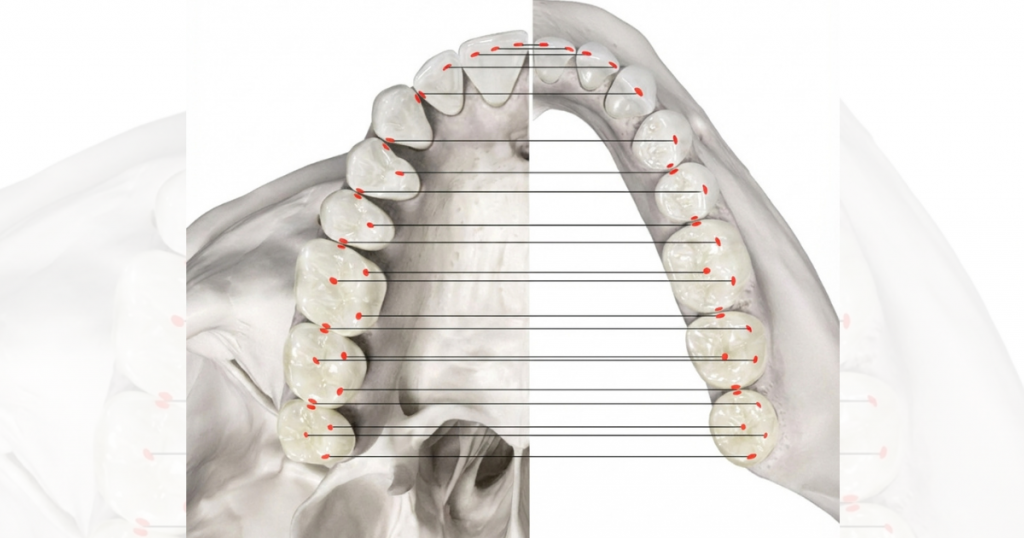Points of contact of opposite teeth in centric occlusion 