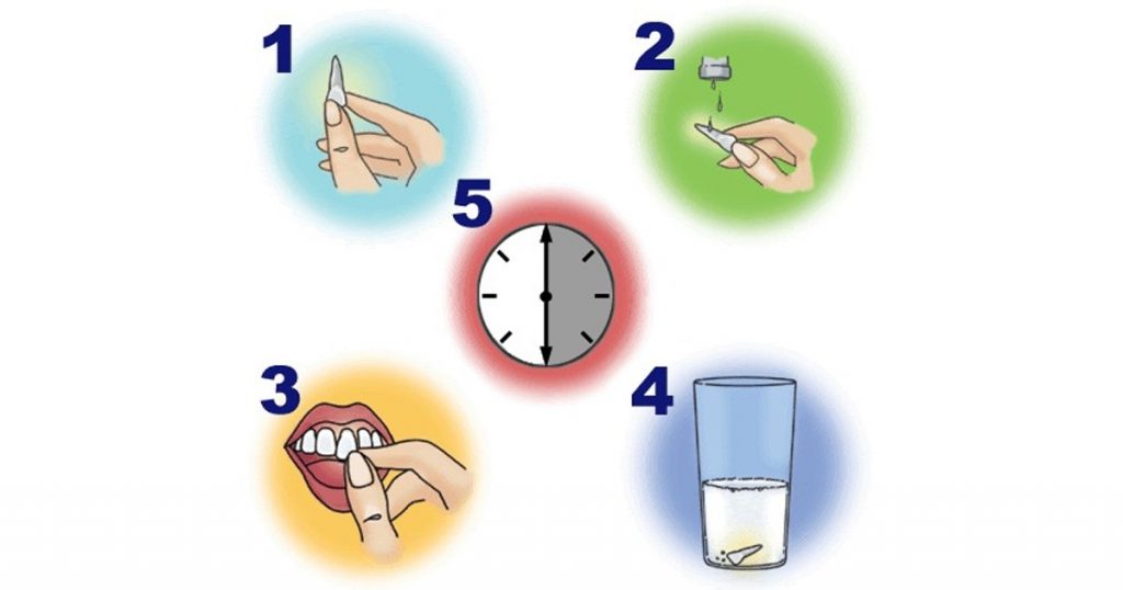 What to Do if a Tooth is Taken Out (Avulsion)